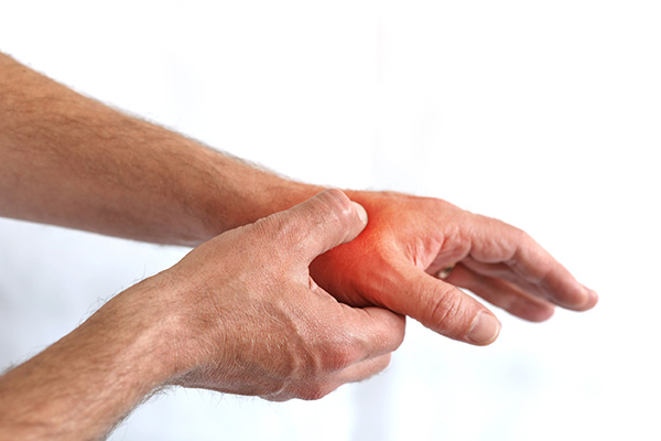 Schmerzen beim Bewegen des Daumens können ein Hinweis auf eine Arthrose des Daumens sein Eine Person hält sich ihre Hand wegen Schmerzen im Daumen fest