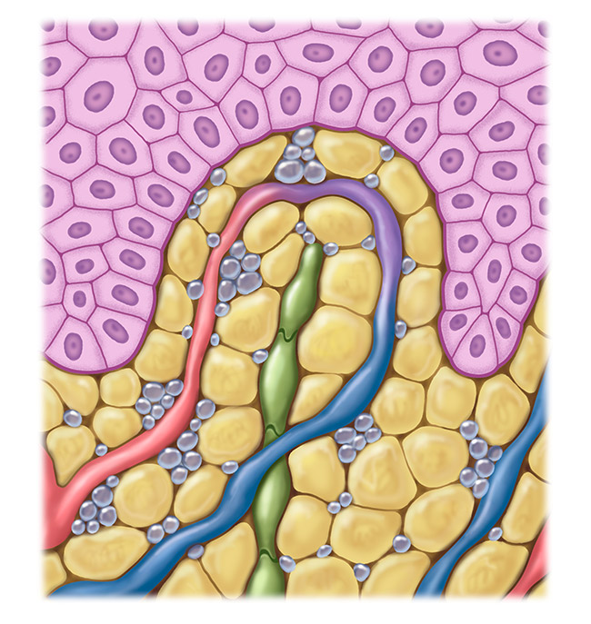 Figure affected lymphatic system