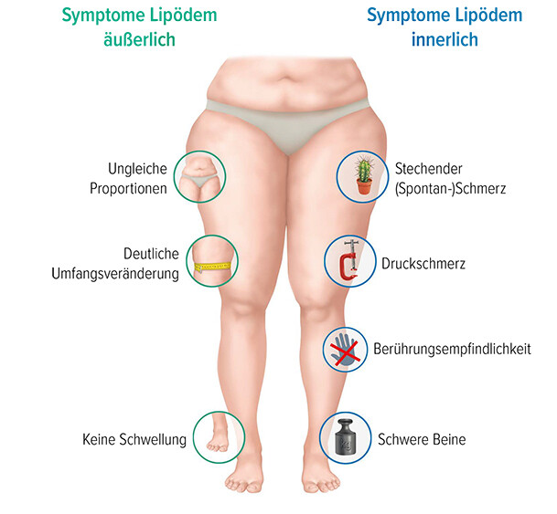 Symptome Lipödem Grafik Symptome Lipödem
